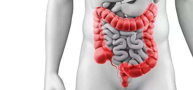 Read more about the article Câncer de Intestino: saiba como diminuir o risco de ter a doença